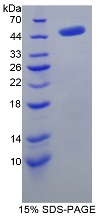 Recombinant Adenosylhomocysteinase (AHCY)