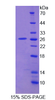 Recombinant Dopa Decarboxylase (DDC)