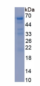 Recombinant Steroidogenic Acute Regulatory Protein (STAR)