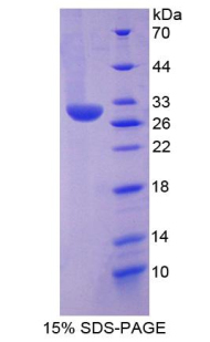 Recombinant Chymase 1, Mast Cell (CMA1)