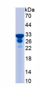 Recombinant Phosphate Cytidylyltransferase 1, Choline Beta (PCYT1b)