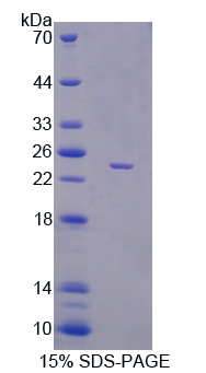 Recombinant Phosphatidylethanolamine Binding Protein 1 (PEBP1)