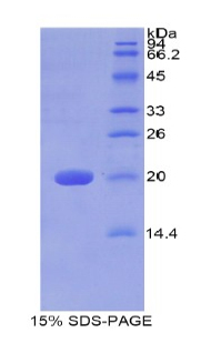 Recombinant Galactosylceramidase (GALC)