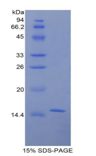 Recombinant Galactosylceramidase (GALC)