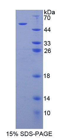 Recombinant Arylsulfatase B (ARSB)