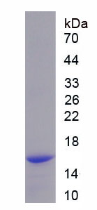 Recombinant Ring Box Protein 1 (RBX1)