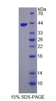 Recombinant Tropomodulin 3 (TMOD3)