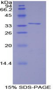 Recombinant TNF Receptor Associated Factor 6 (TRAF6)