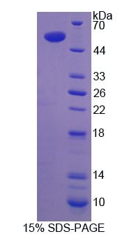 Recombinant Transcription Termination Factor, RNA polymerase I (TTF1)