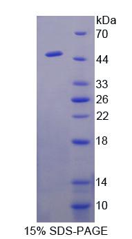 Recombinant Transcobalamin II, Macrocytic Anemia (TCN2)