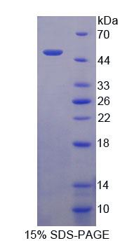 Recombinant Transcobalamin II, Macrocytic Anemia (TCN2)