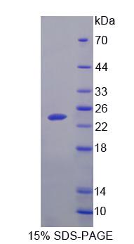 Recombinant Spermidine/Spermine N1-Acetyltransferase 1 (SAT1)