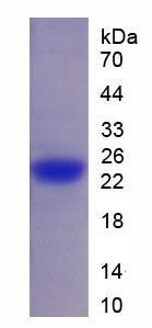 Recombinant Spermidine/Spermine N1-Acetyltransferase 1 (SAT1)