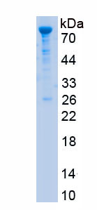 Recombinant Lysine Specific Demethylase 1A (KDM1A)