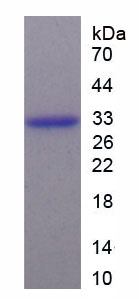 Recombinant Secretagogin (SCGN)