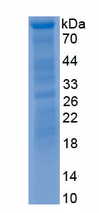 Recombinant Polyribonucleotide Nucleotidyltransferase 1 (PNPT1)