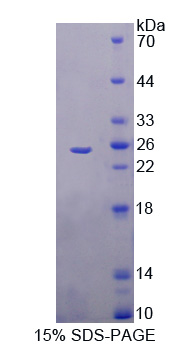 Recombinant Trehalase (TREH)