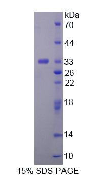 Recombinant Trehalase (TREH)