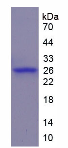 Recombinant WNT1 Inducible Signaling Pathway Protein 2 (WISP2)