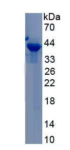 Recombinant Uracil DNA Glycosylase (UNG)