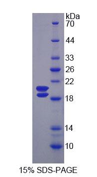 Recombinant Uromodulin (UMOD)