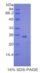 Recombinant Ubiquitin Carboxyl Terminal Hydrolase L5 (UCHL5)