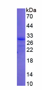 Recombinant Ubiquitin Carboxyl Terminal Hydrolase L3 (UCHL3)