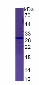 Recombinant Ubiquitin Carboxyl Terminal Hydrolase L3 (UCHL3)