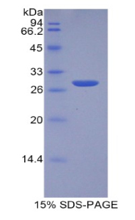 Recombinant Tumor Protein, Translationally Controlled 1 (TPT1)