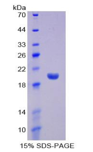 Recombinant Interferon Alpha 13 (IFNa13)