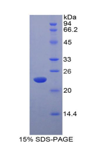 Recombinant Interferon Alpha 5 (IFNa5)