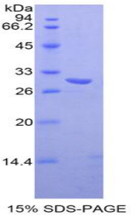 Recombinant TXK Tyrosine Kinase (TXK)