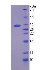 Recombinant Tumor Protein p53 Binding Protein 1 (TP53BP1)