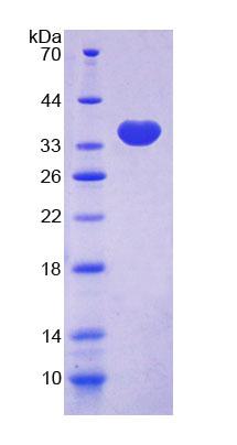 Recombinant Talin 2 (TLN2)