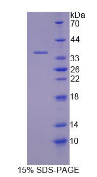 Recombinant Transketolase (TKT)