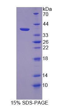 Recombinant TANK Binding Kinase 1 (TBK1)