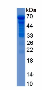 Recombinant Sulfatase 2 (SULF2)