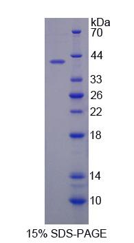 Recombinant Sulfatase 2 (SULF2)