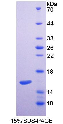 Recombinant Serine Palmitoyltransferase, Long Chain Base Subunit 2 (SPTLC2)