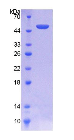 Recombinant Serine Peptidase Inhibitor Kunitz Type 2 (SPINT2)