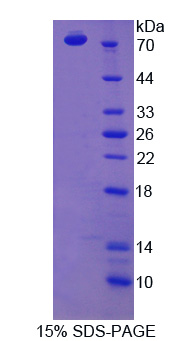 Recombinant Scavenger Receptor Class B Member 1 (SCARB1)