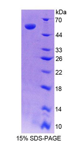 Recombinant Retinoic Acid Receptor Responder 1 (RARRES1)