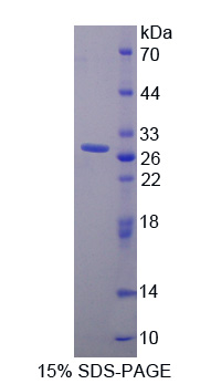 Recombinant Prolactin Receptor (PRLR)