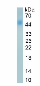 Recombinant Protein Phosphatase, Mg2+/Mn2+ Dependent 1A (PPM1A)