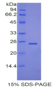 Recombinant Peroxisome Proliferator Activated Receptor Gamma Coactivator 1 Alpha (PPARgC1a)