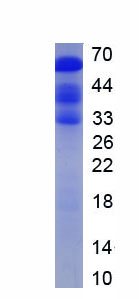 Recombinant Peroxisome Proliferator Activated Receptor Gamma Coactivator 1 Alpha (PPARgC1a)