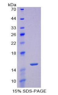 Recombinant Periostin (POSTN)