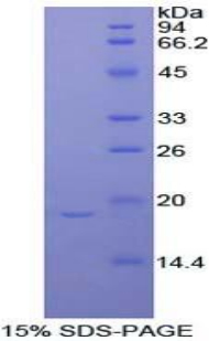 Recombinant Periostin (POSTN)