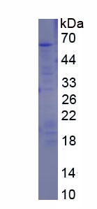 Recombinant Plexin B1 (PLXNB1)