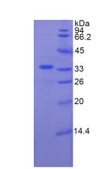 Recombinant Plexin B1 (PLXNB1)